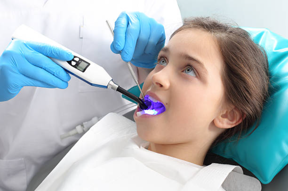 dental sealants for kids katy tx